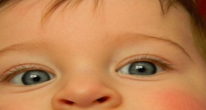 مدى تأثير أشعة الليزر على عين طفلك